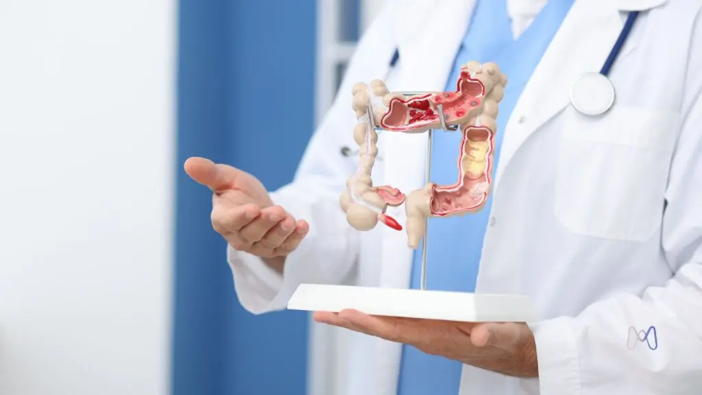 Endometriose intestinal: como identificar os sinais e por que ela costuma ser confundida