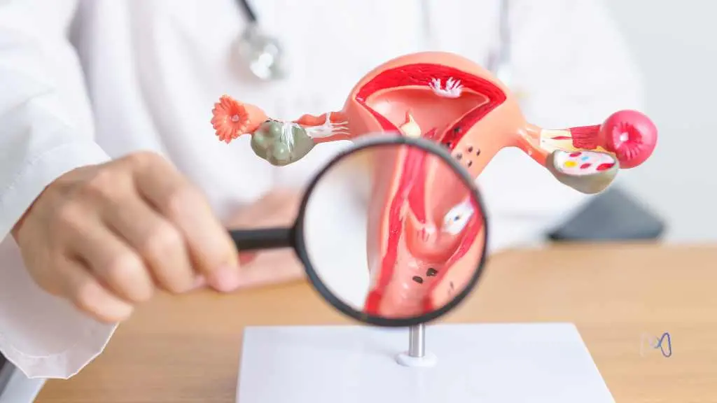 Por que o exame nem sempre explica a intensidade dos sintomas da endometriose